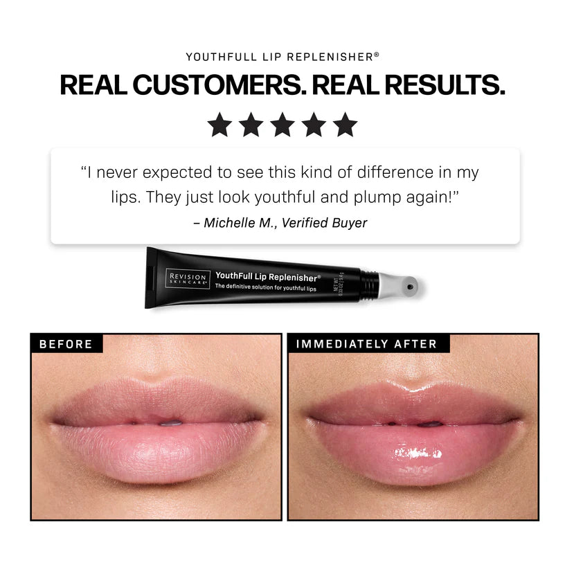 YouthFull Lip Replenisher® 1-Pack