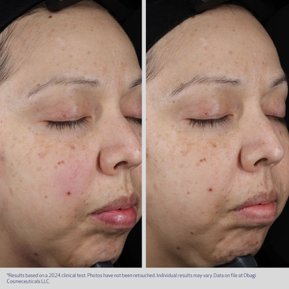 SUZANOBAGIMD® Moisture Restore