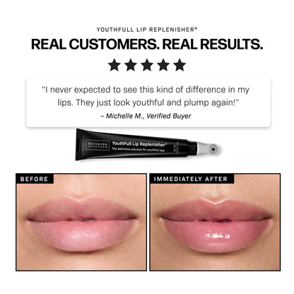 YouthFull Lip Replenisher® 1-Pack